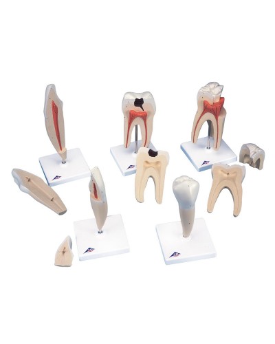 Ատամների դասական մոդելների հավաքածու, 5 մոդելներ